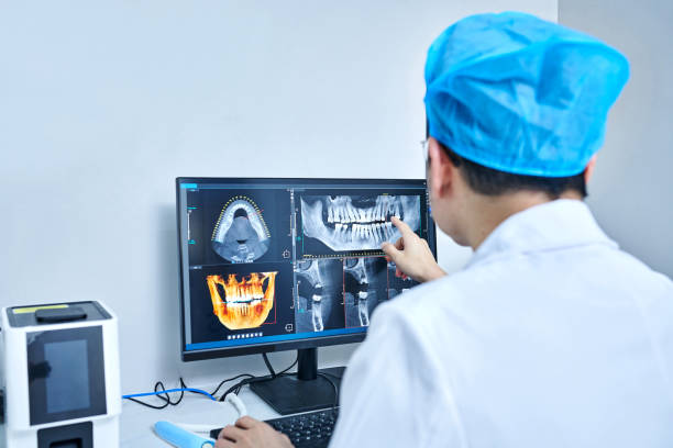 Best Emergency Wisdom Teeth Removal in Indian Springs, GA